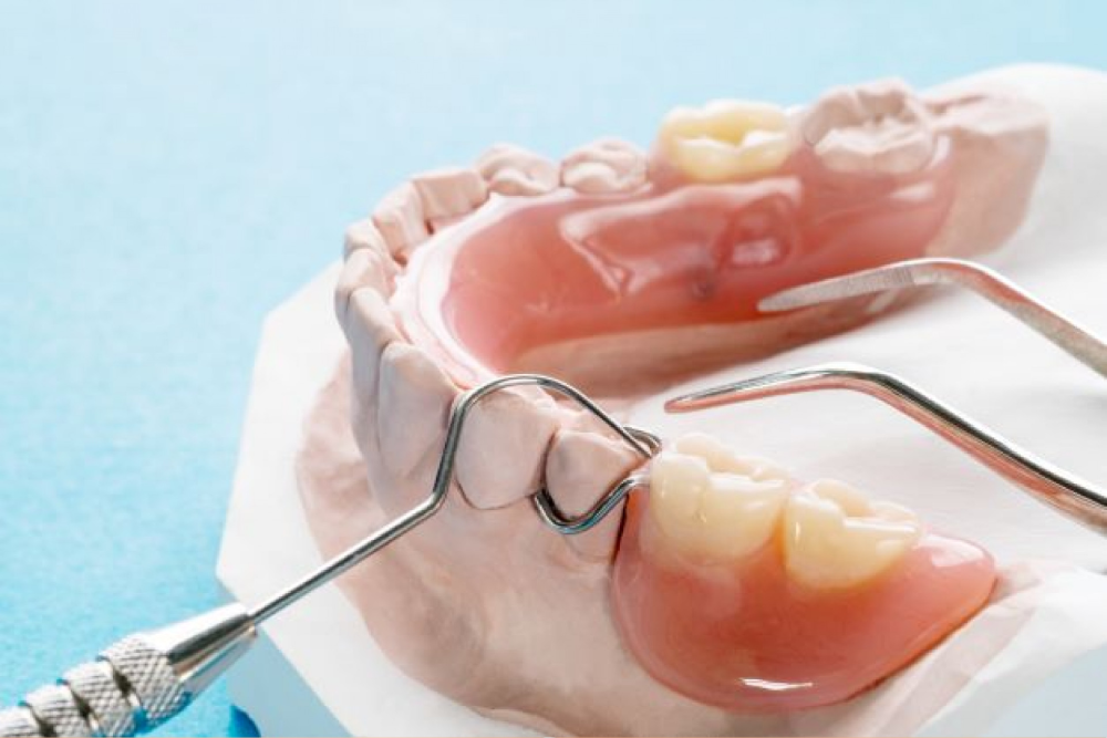 tooth removal in Kathmandu Nepal dentist procedure