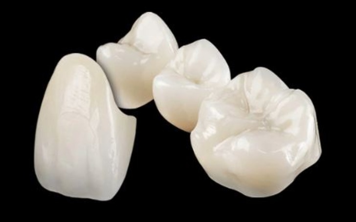 A zirconia crown is made from zirconium dioxide. It has exceptional strength and durability.