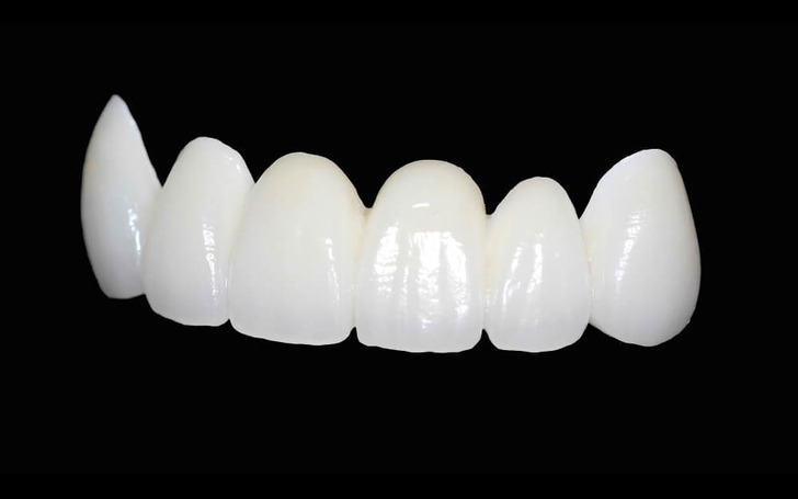 At Chirayu Dentcare, we provide exceptional zirconia crown treatments using advanced CAD/CAM technology.