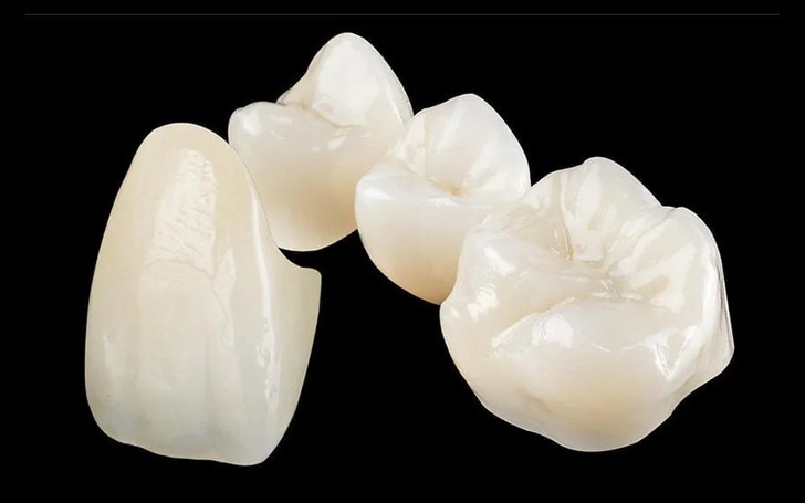 All-Ceramic Dental Crown Price in Kathmandu Nepal at Chirayu Dentcare