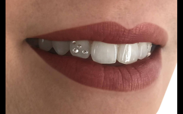 Diamond tooth jewelry application in Kathmandu