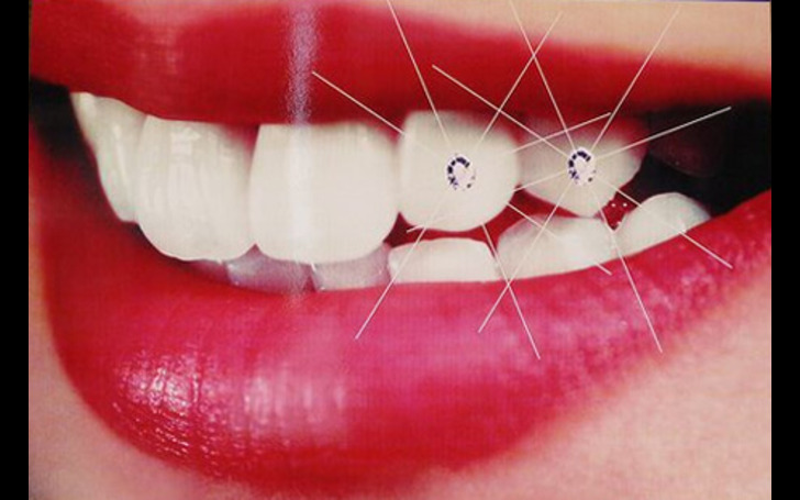 What is tooth jewelry explained Kathmandu