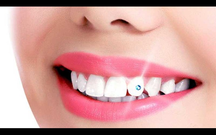 Is dental jewelry safe for oral health