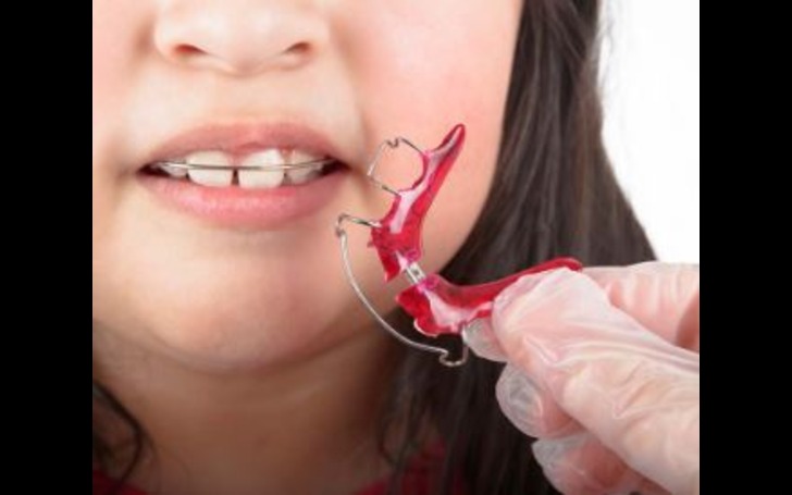 A metal wire retainer 