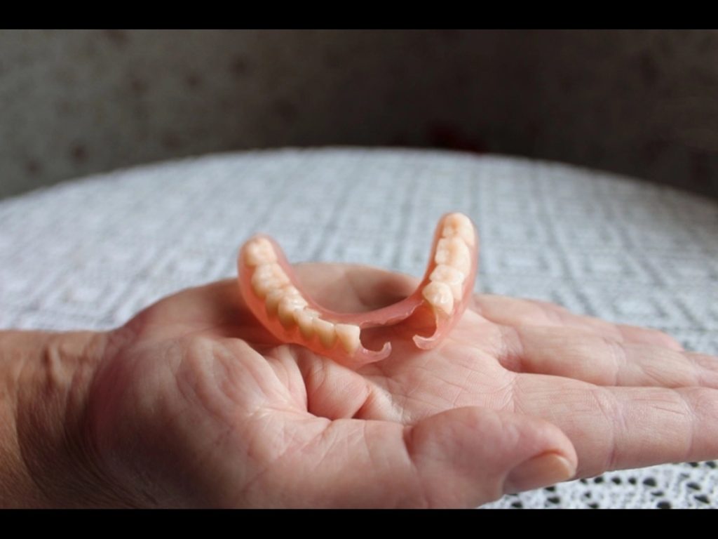 Dentures cost in Nepal